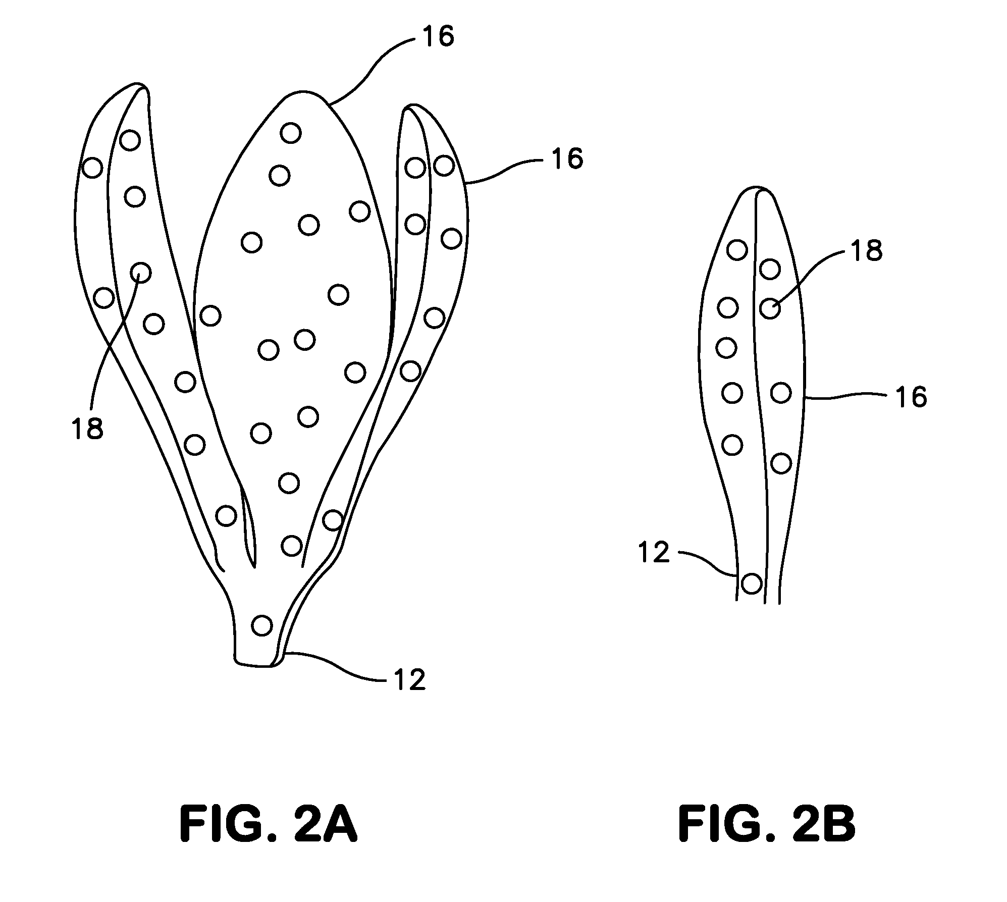 Gastric Sponge System and Use Thereof