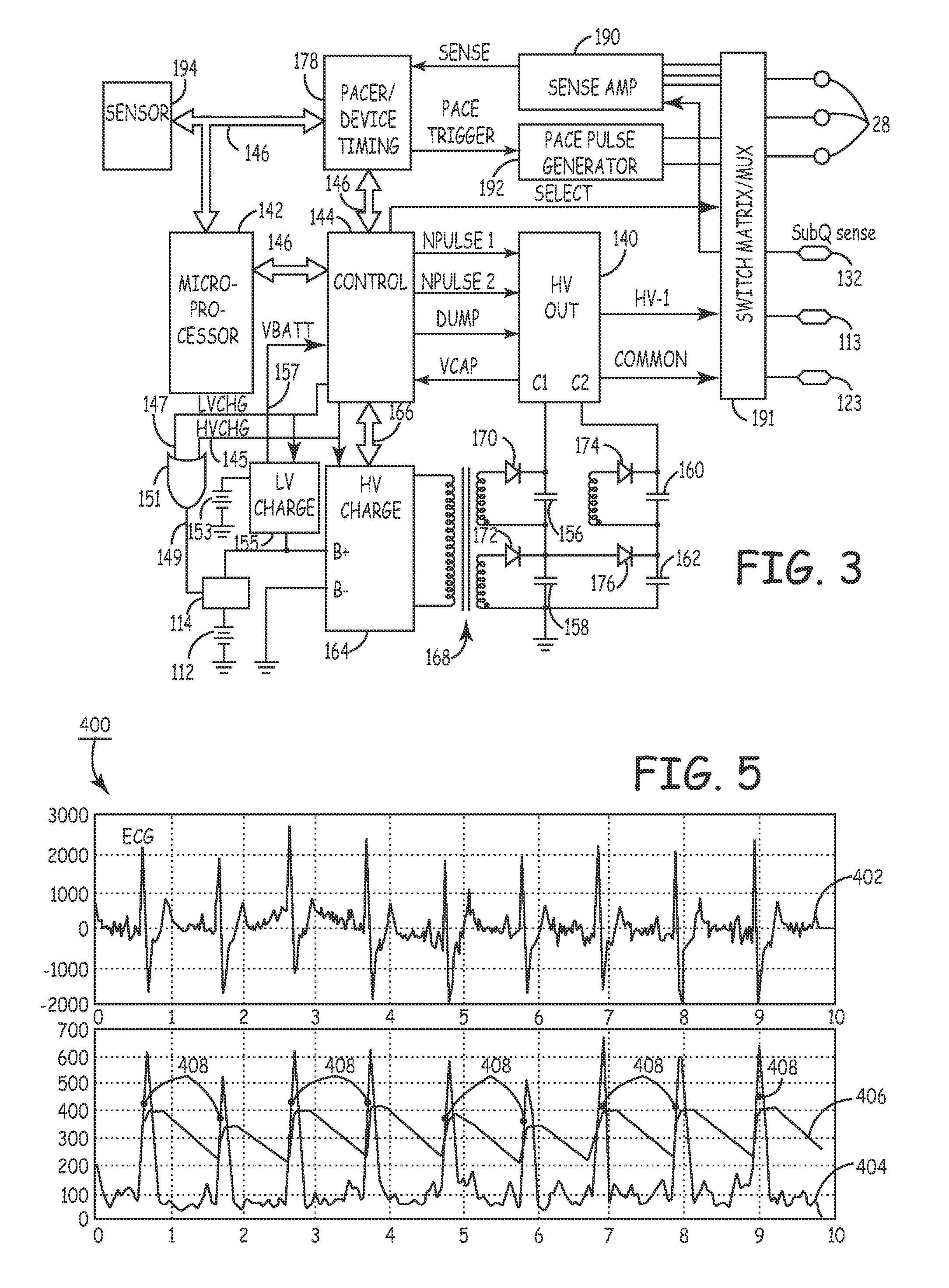 Method and apparatus for detecting arrhythmias in a medical device