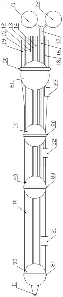 Three-balloon ureteral liquid-gas expansion pipeline suite