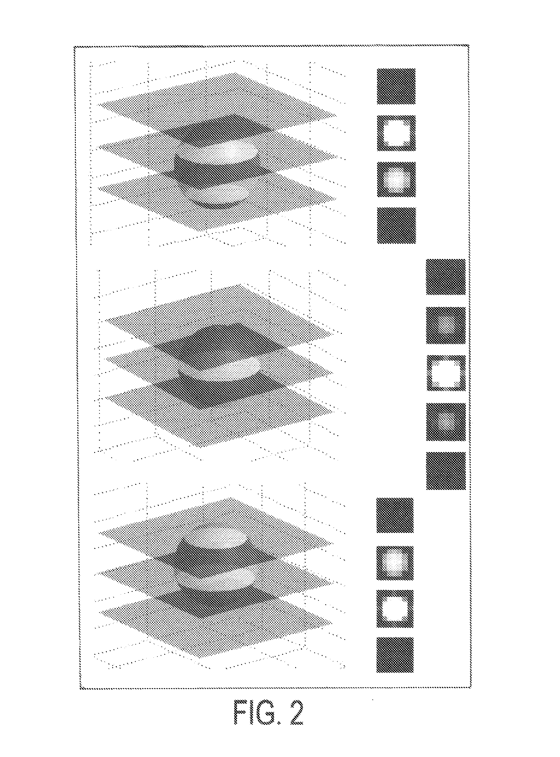 Method and system for detecting lung tumors and nodules