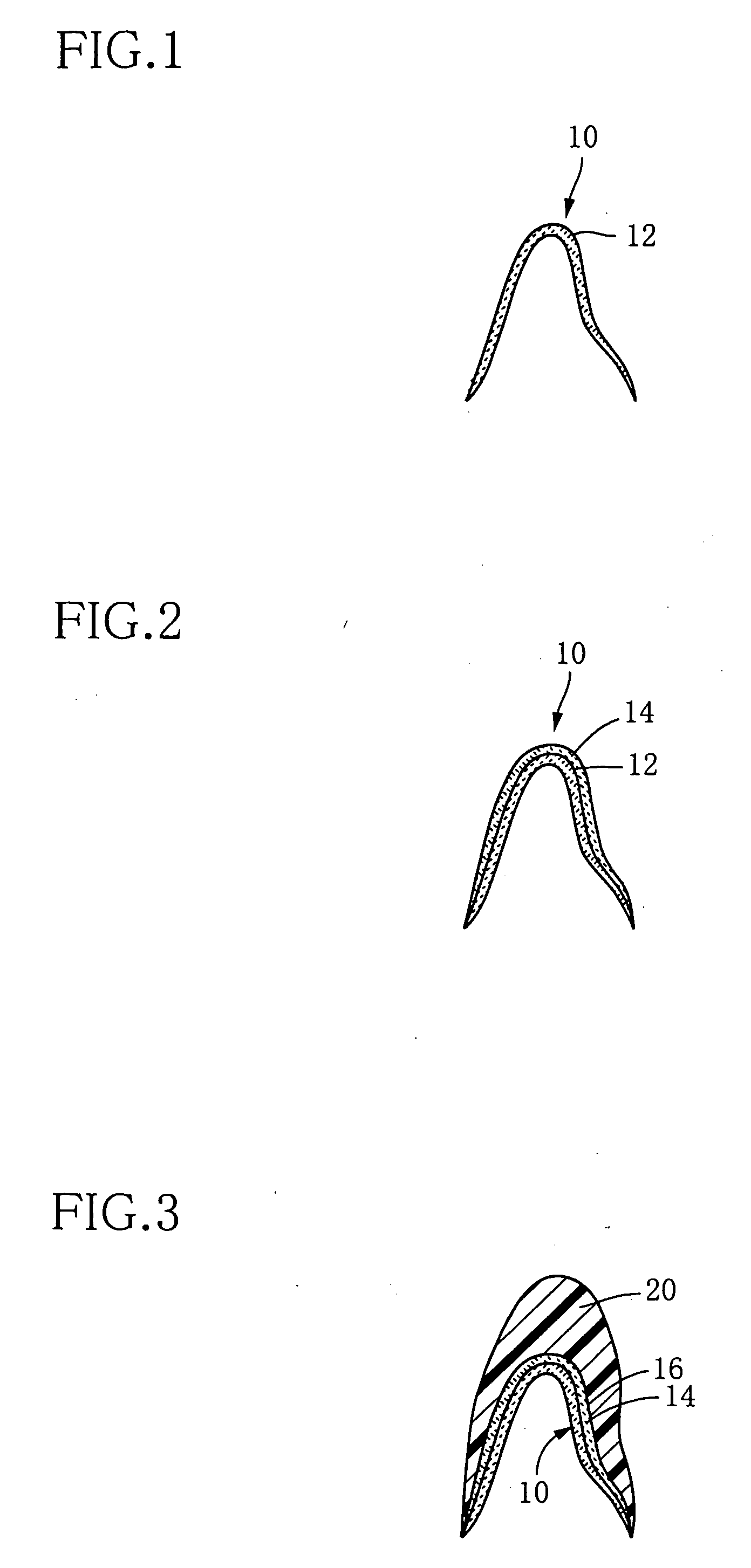 Process for producing dental prosthesis and kit for use for therein