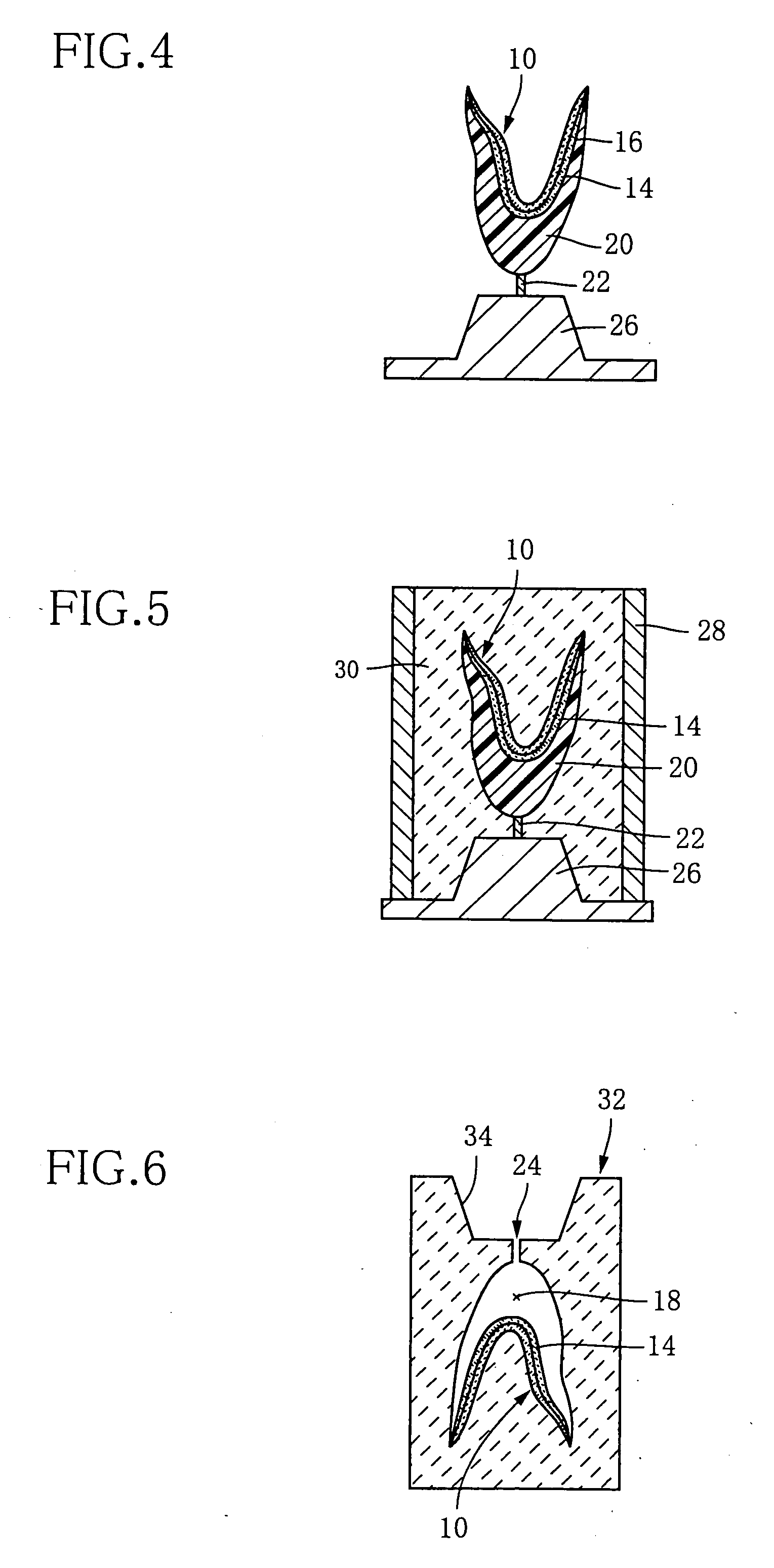 Process for producing dental prosthesis and kit for use for therein