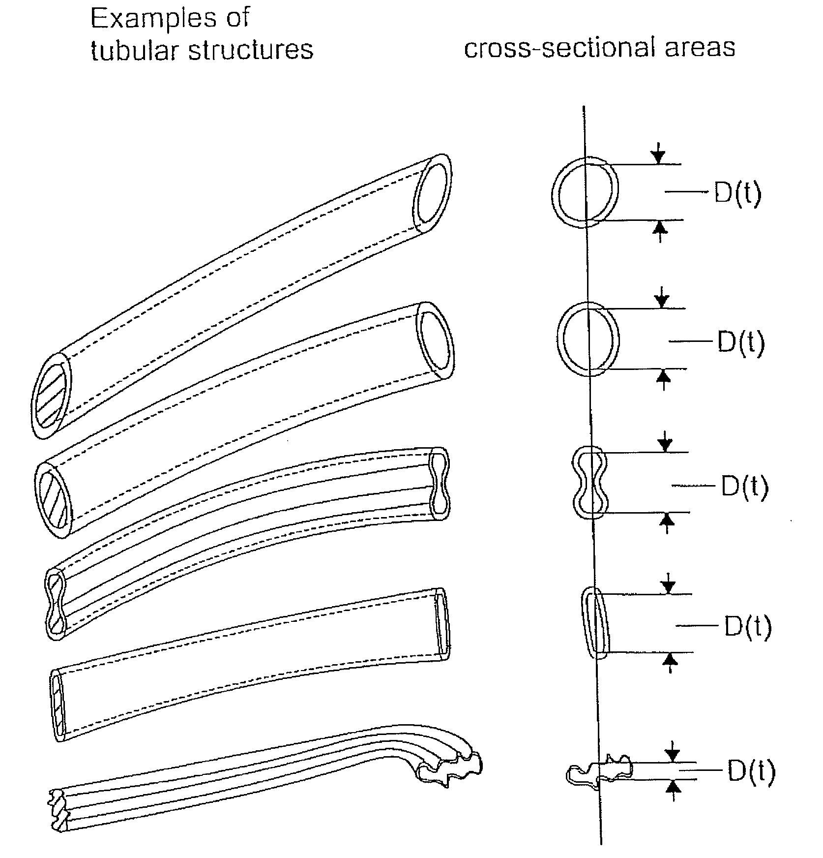 Hybrid hemodialysis access grafts or a hybrid femoral artery bypass graft and systems and methods for producing or modifying the same
