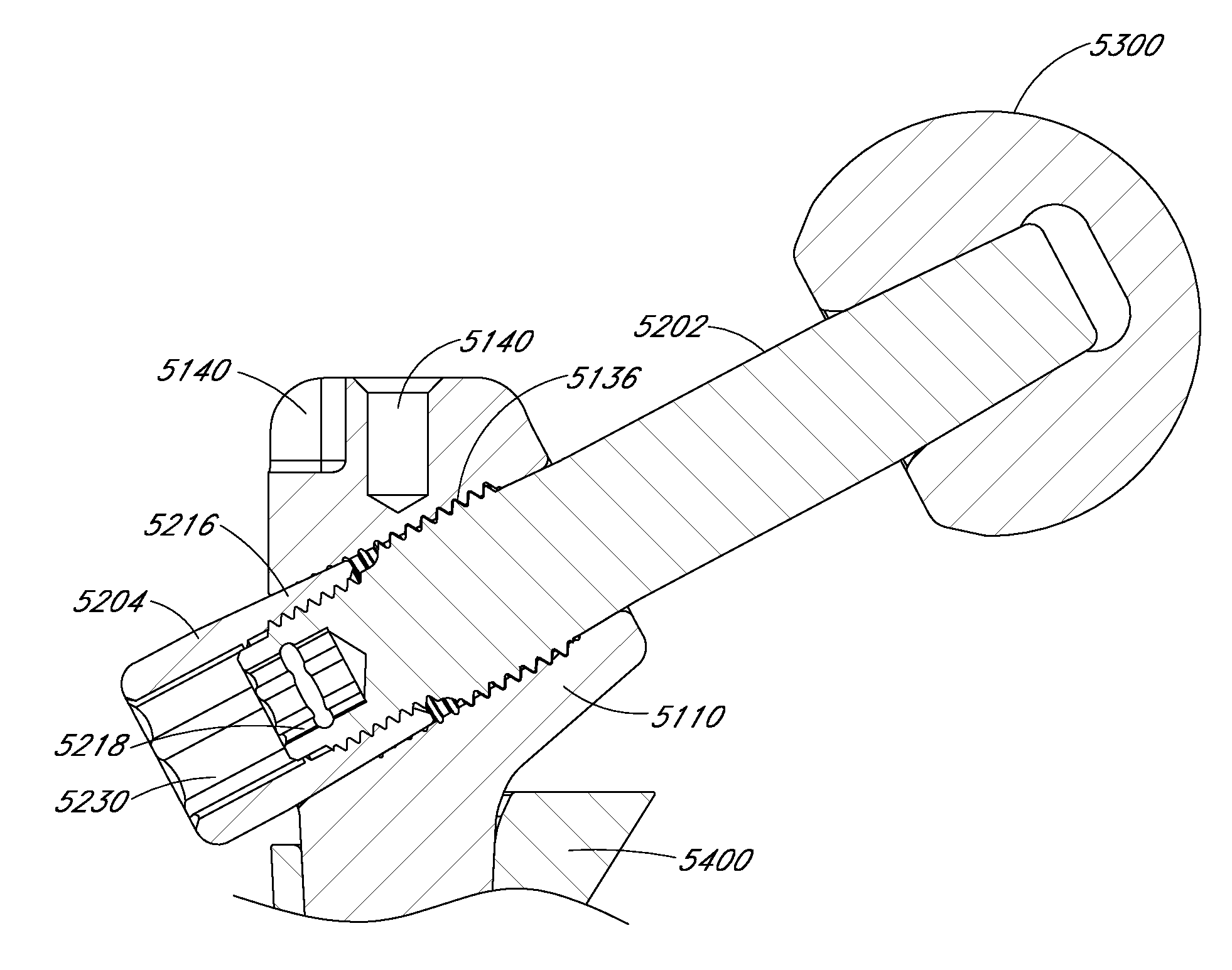 Method and apparatus for hip replacement