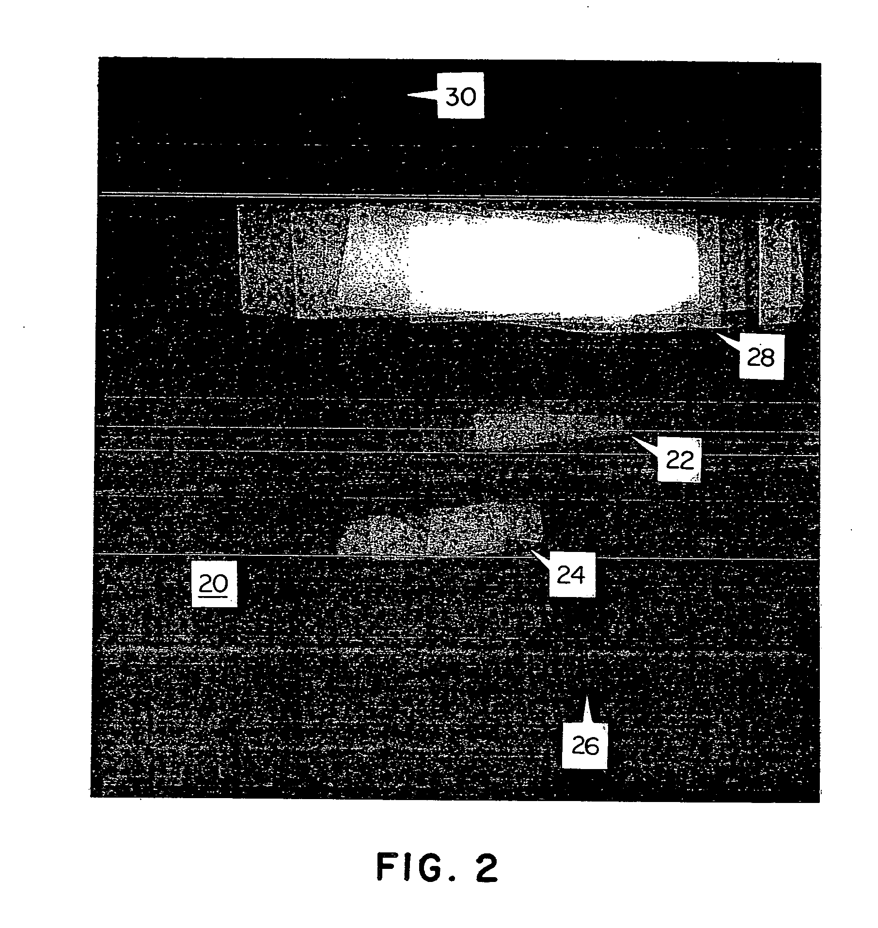 Intermediate density marker and a method using such a marker for radiographic examination