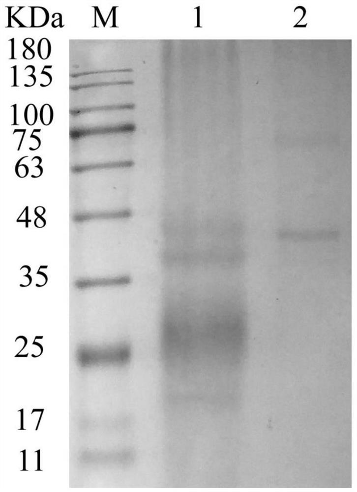 Preparation and application of zilpaterol hapten, complete antigen and monoclonal antibody