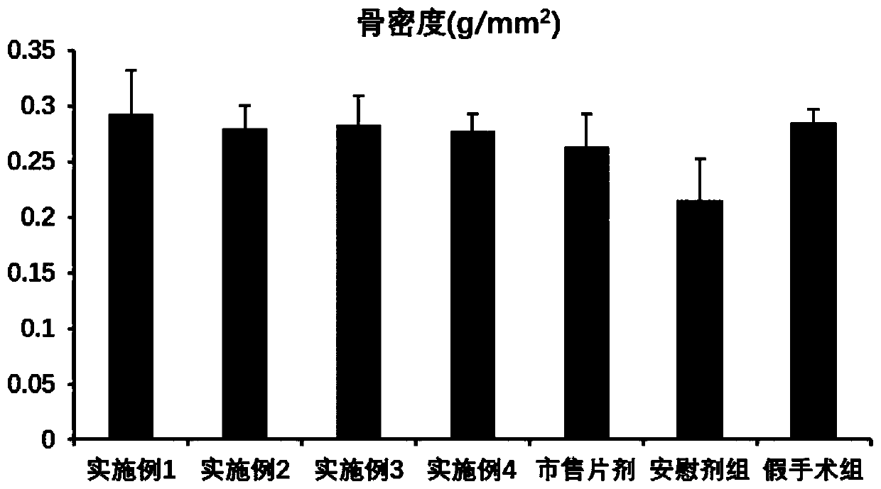 Alfacalcidol oral liposome drug and preparation method and application thereof