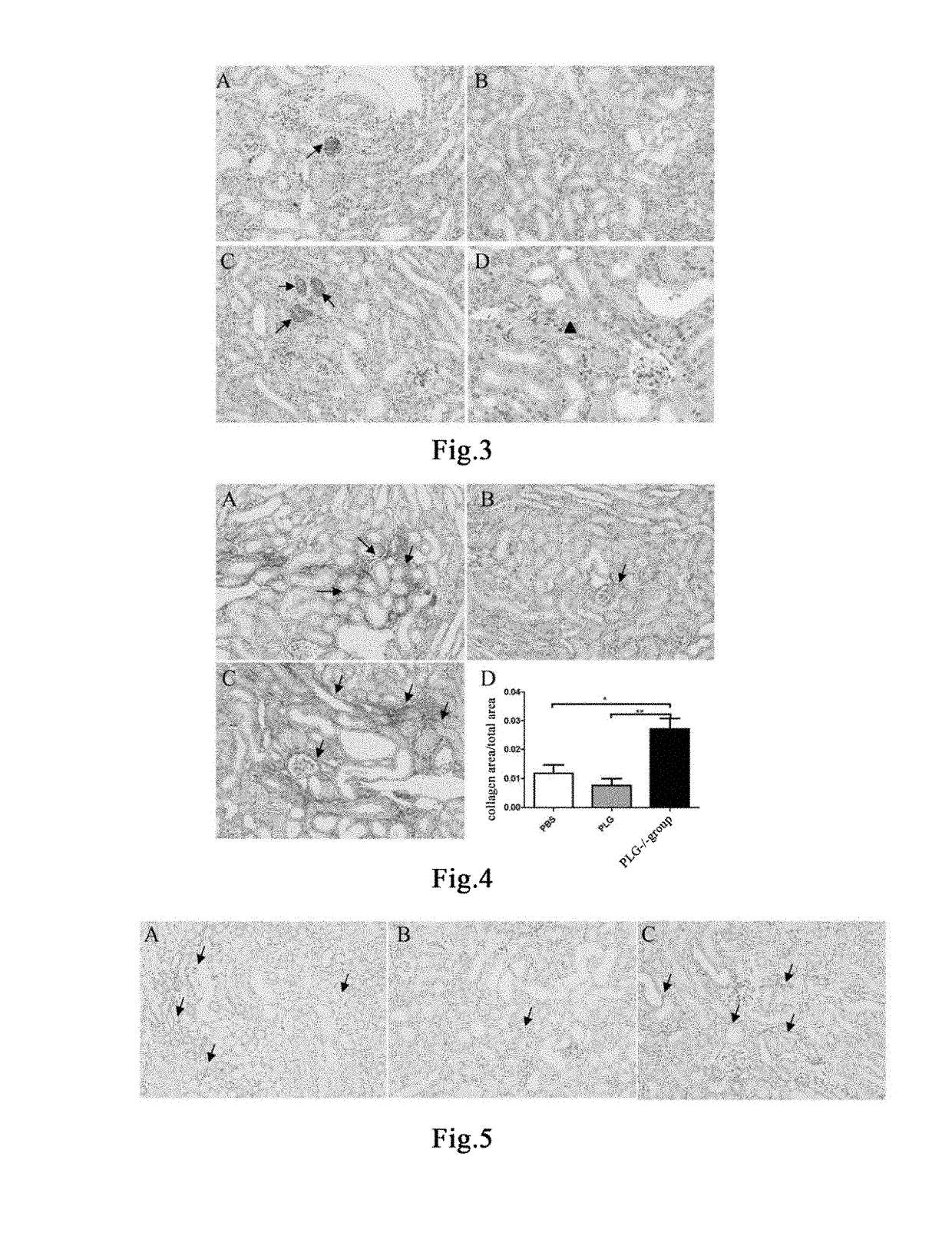 Method for preventing and treating drug-induced renal injury