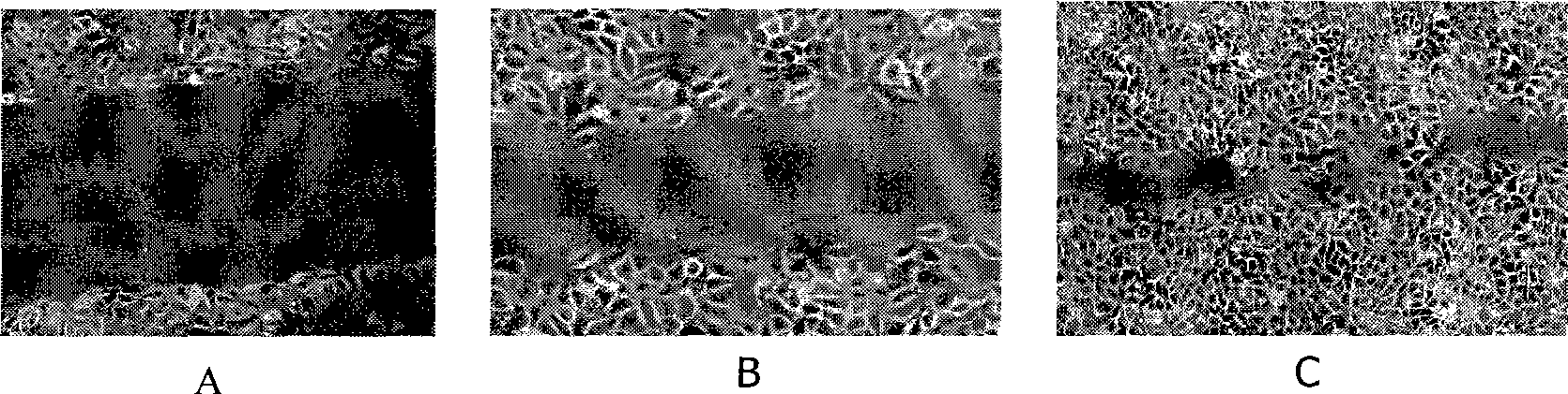 Use of oligosaccharide in preparing medicine for treating tumor and inhibiting tumor metastasis