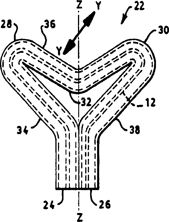 Urinary incontinence device and method of making same