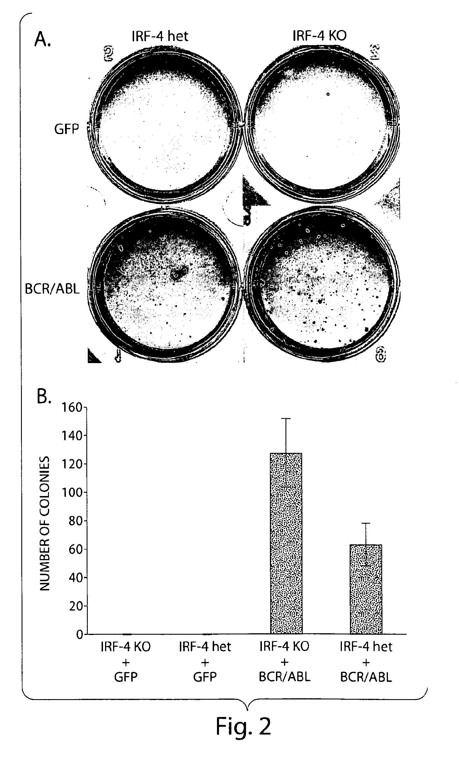 Irf-4 as a tumor suppressor and uses thereof