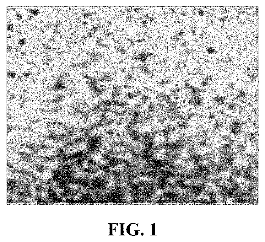 Speckle reduction instrument