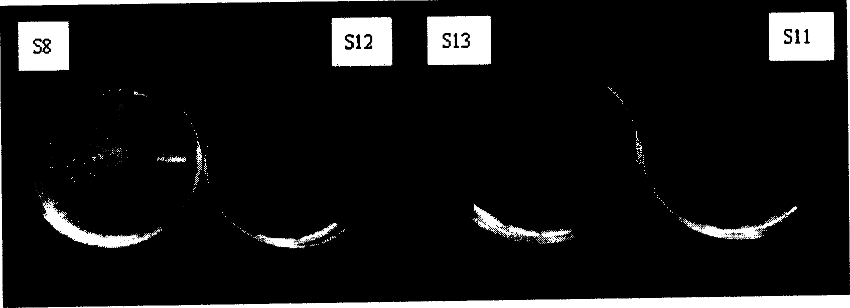Method for preparing silver-enriched antibacterial film on pyrolytic carbon and TiN film for medical use