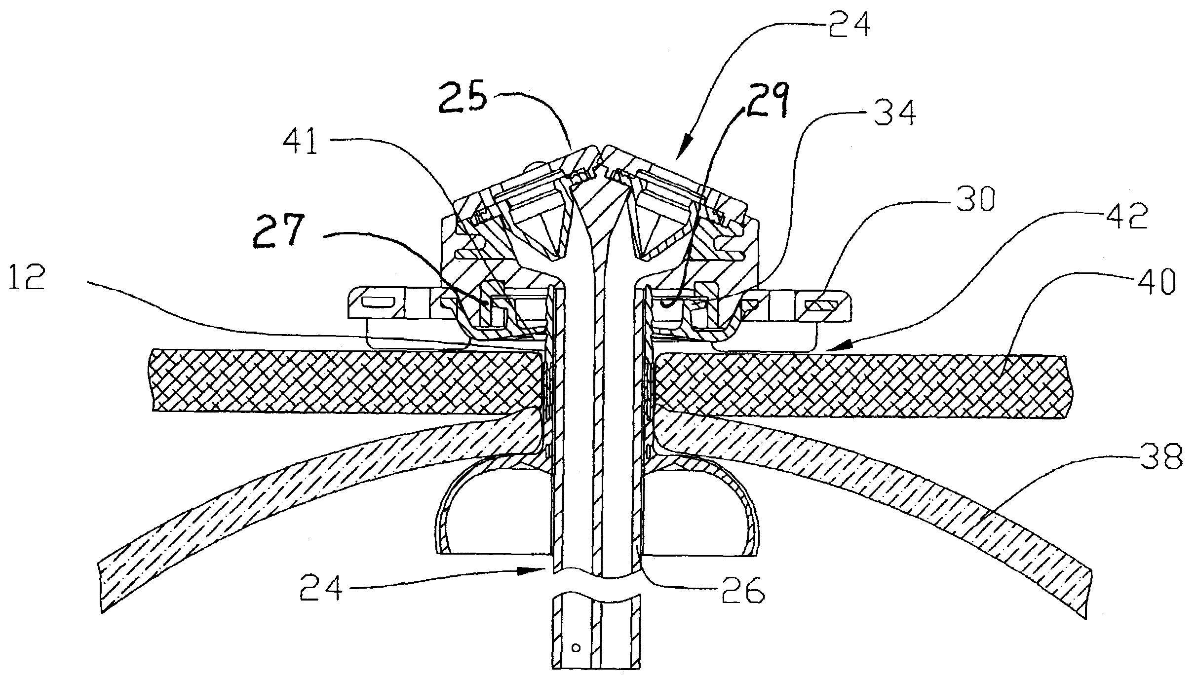 Artificial stoma and method of use