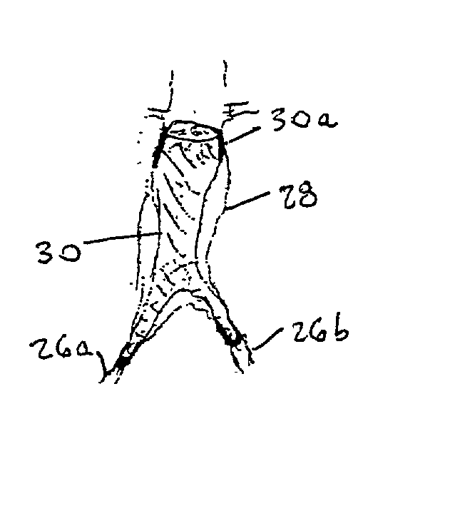Radially expandable endoprosthesis device with two-stage deployment