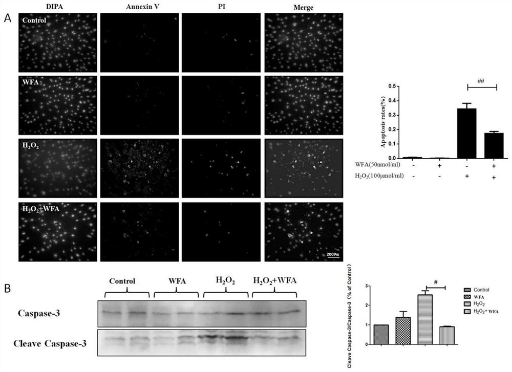 Application of withaferin A in preparation of medicine for treating fundus ischemic disease