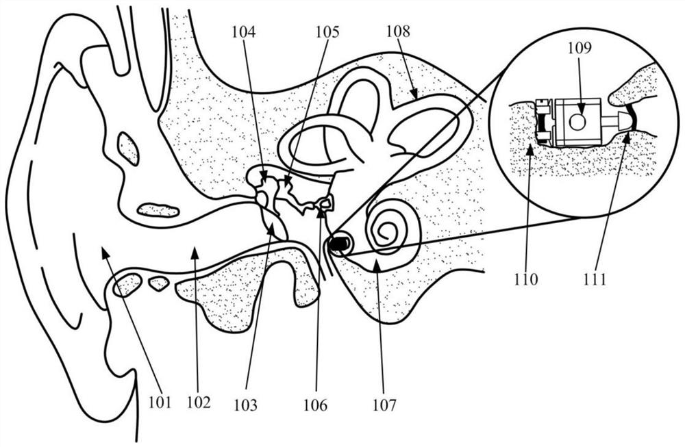 A circular window-excited vibration artificial middle ear actuator with variable initial pressure and stiffness adjustment