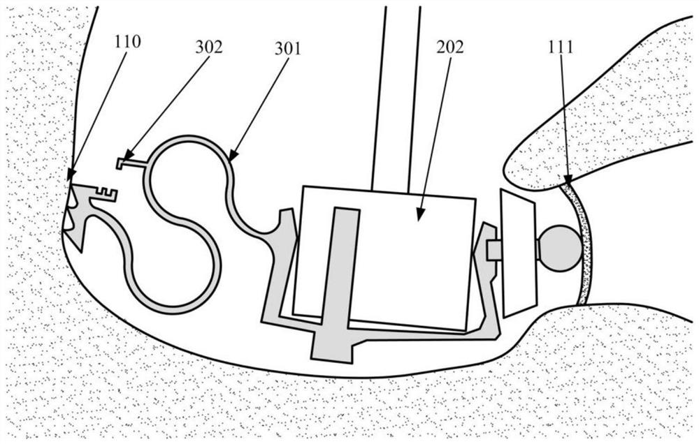 A circular window-excited vibration artificial middle ear actuator with variable initial pressure and stiffness adjustment