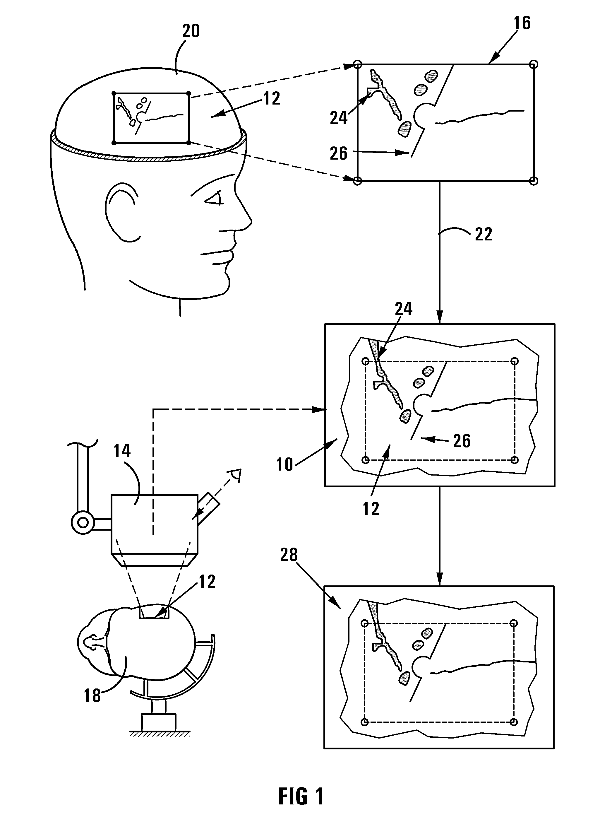 Method of and system for overlaying NBS functional data on a live image of a brain