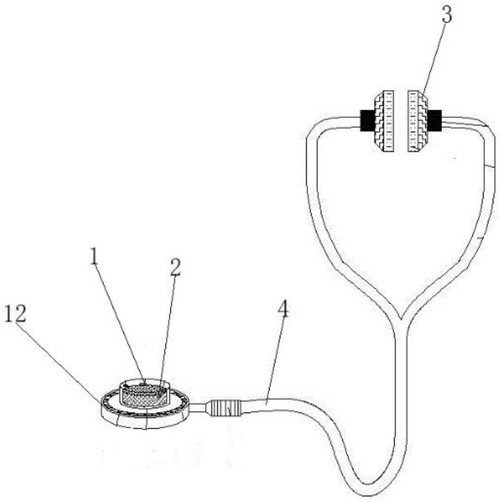 Intelligent stethoscope