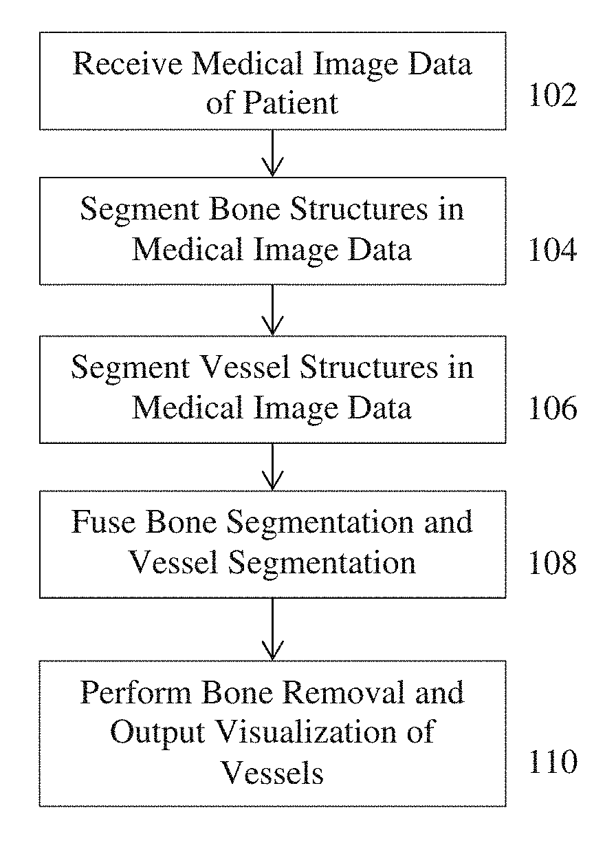 Method and system for whole body bone removal and vascular visualization in medical image data