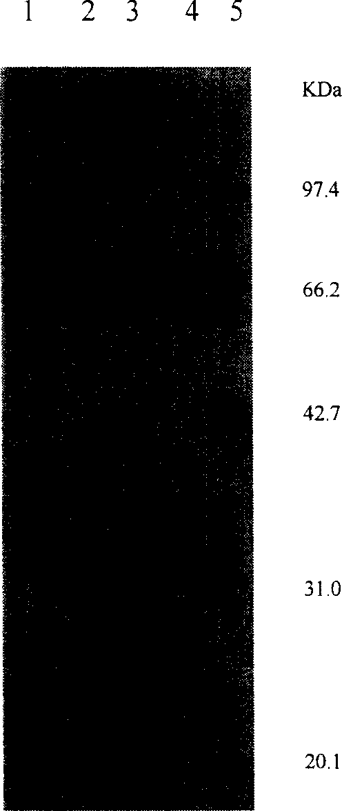 Method for preparing human pancreatic glucagons like polypeptide - 1, and fusion proten of human serum albumin, and products