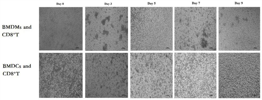 Tumor immunotherapy composition based on specific immune cells, preparation method and application