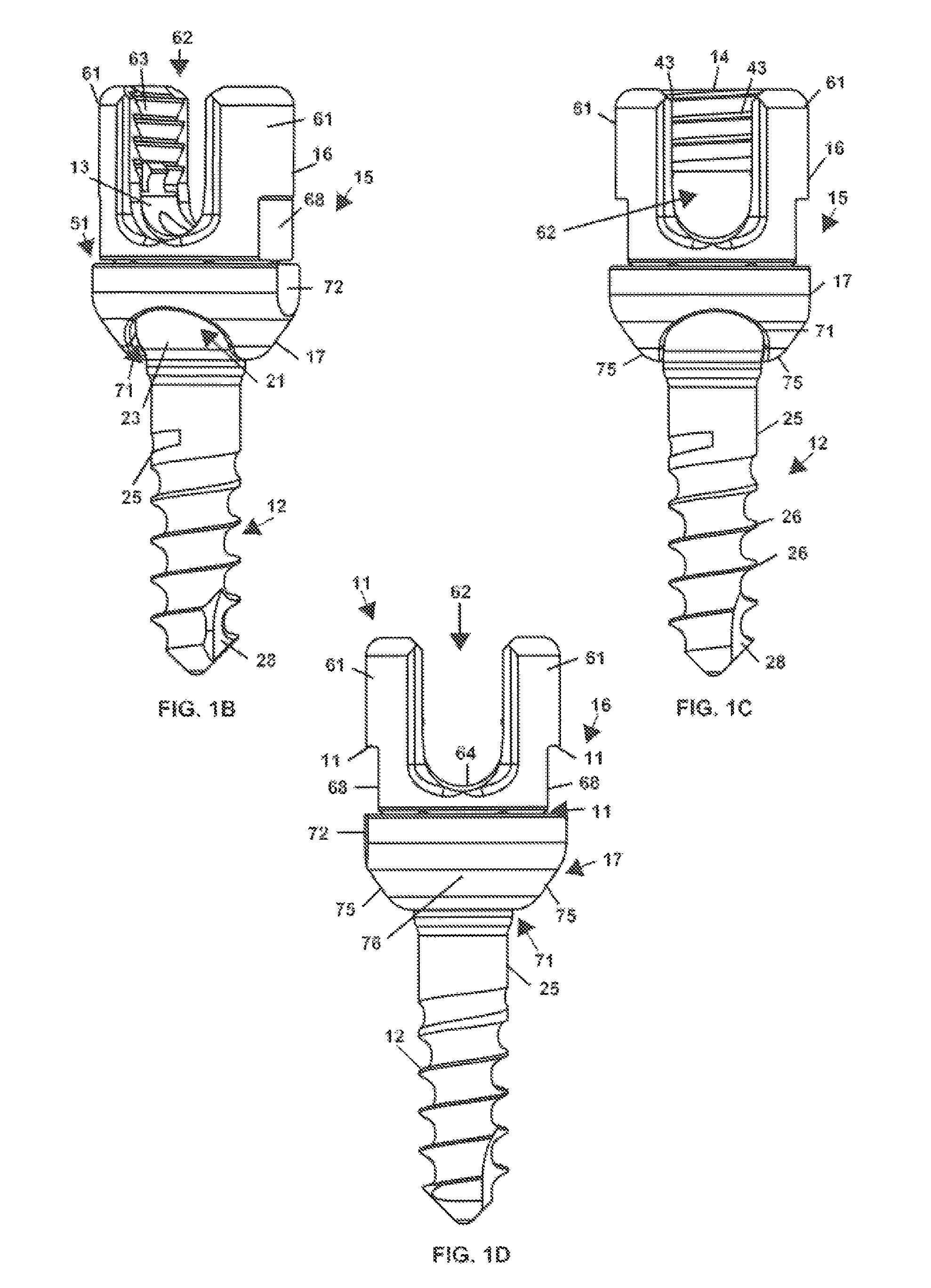 Wide angulation coupling members for bone fixation system