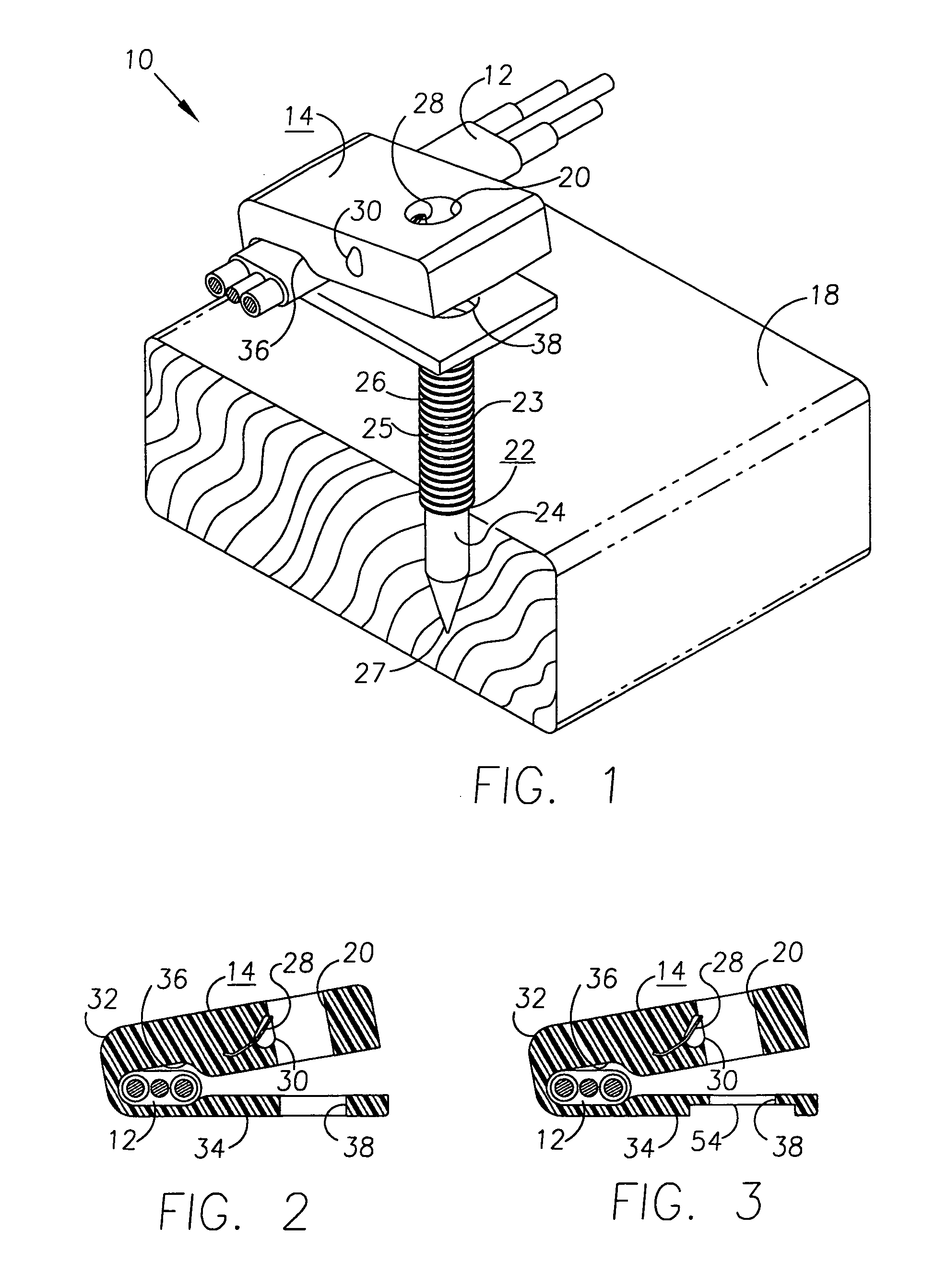 Fastener and method for supporting elongated material