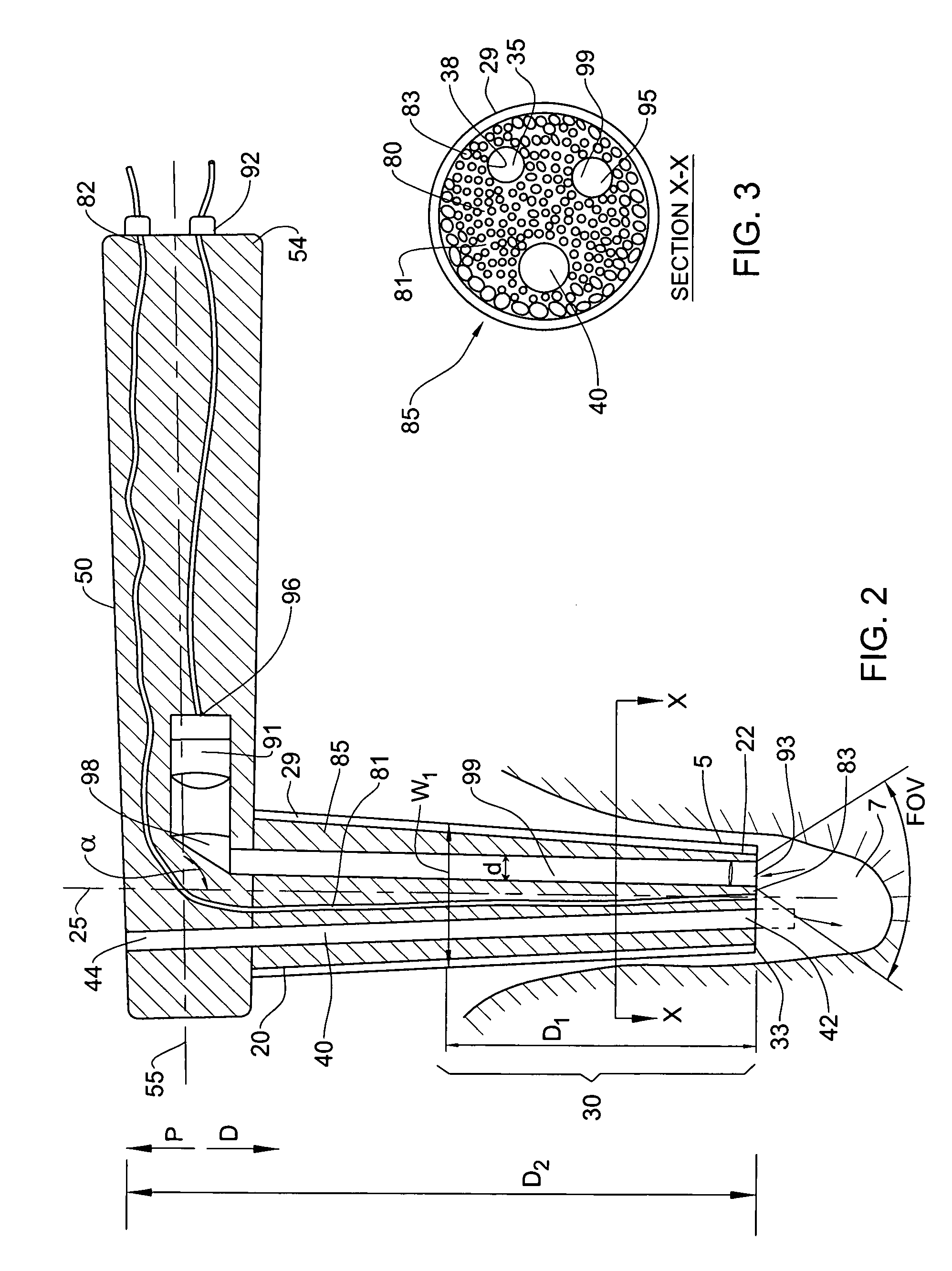 Device, system and method for procedures associated with the intra-oral cavity