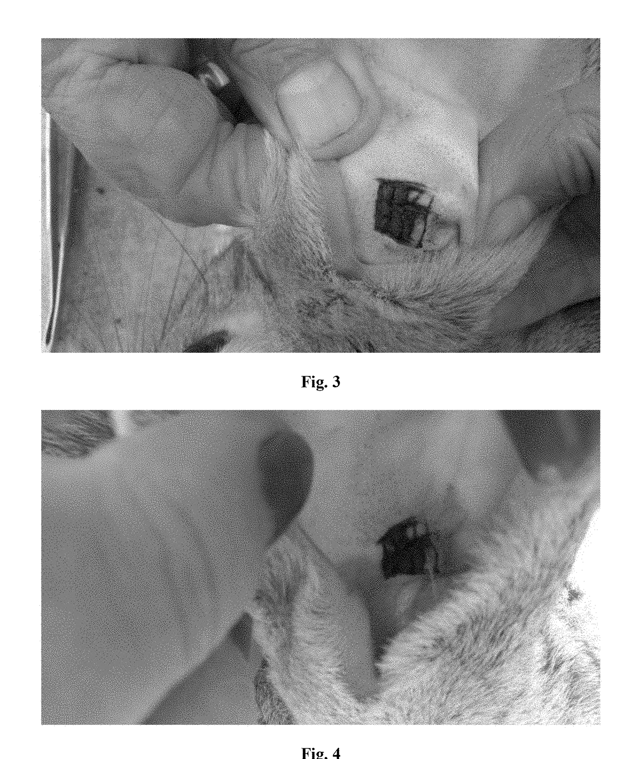 Pharmaceutical composition for treatment of inflammatory ear diseases, method for producing same and method for treatment using said composition