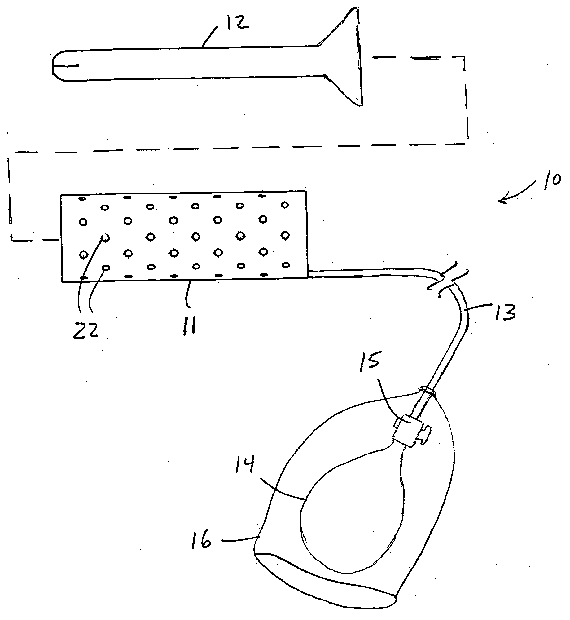 Inflatable apparatus for accessing body cavity and methods of making