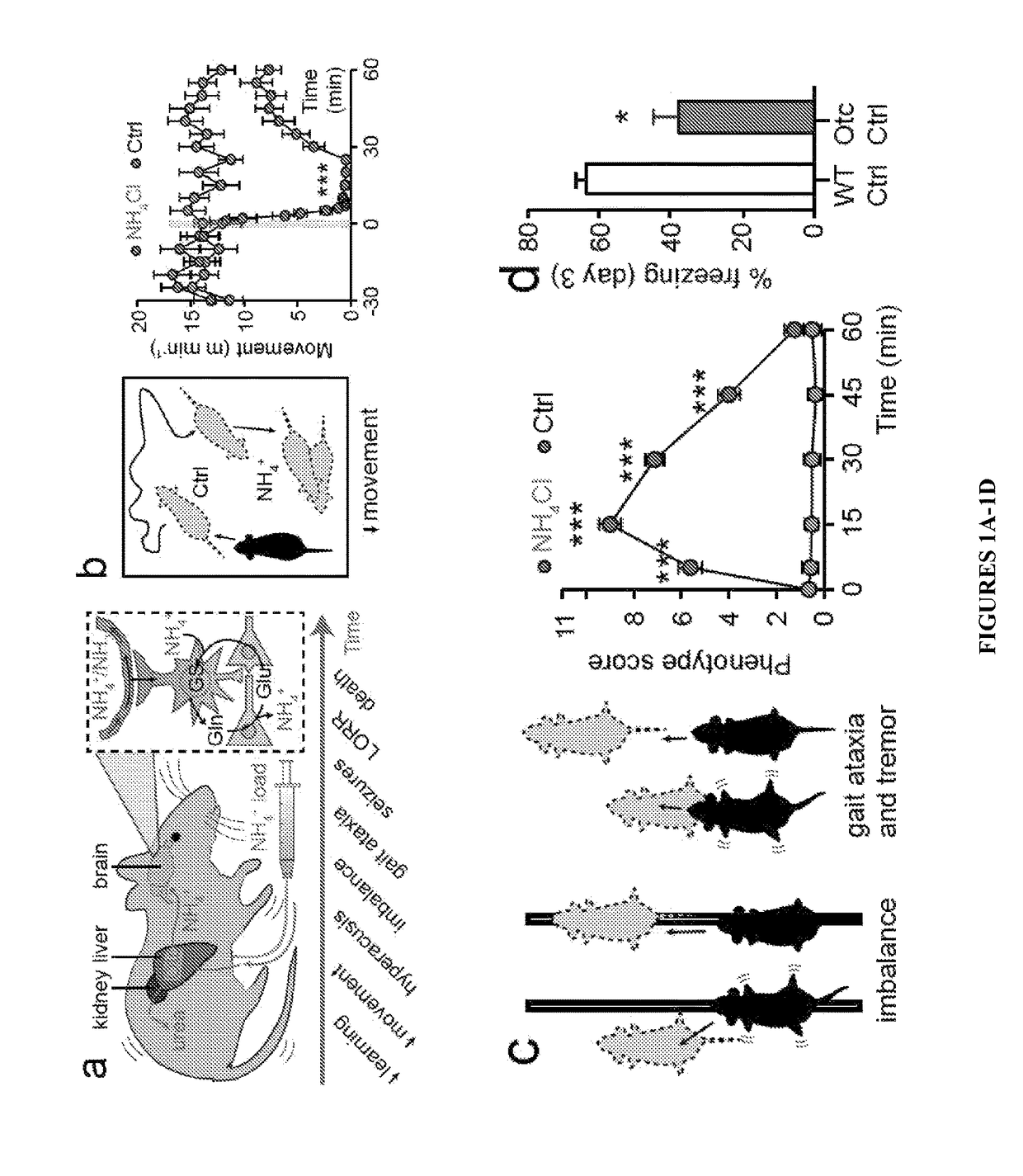 Method of treating and preventing brain impairment using Na<sup>+</sup>-K<sup>+</sup>-2Cl-cotransporter isoform 1 inhibitors