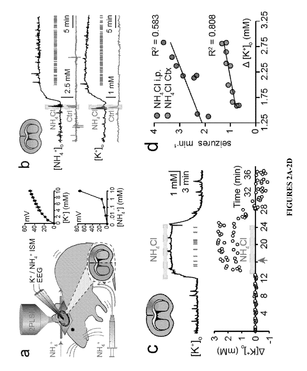 Method of treating and preventing brain impairment using Na<sup>+</sup>-K<sup>+</sup>-2Cl-cotransporter isoform 1 inhibitors