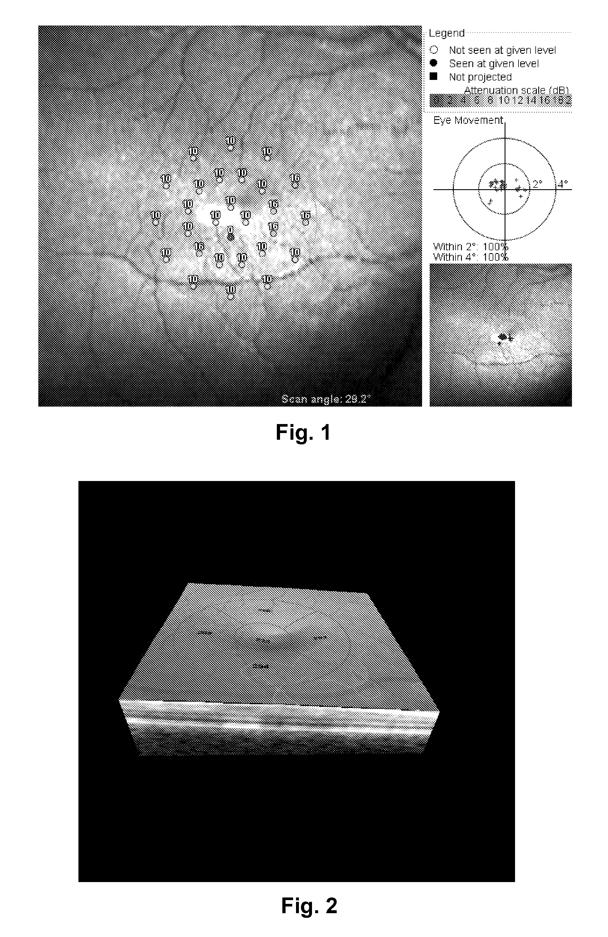 Method for Performing Micro-Perimetry and Visual Acuity Testing