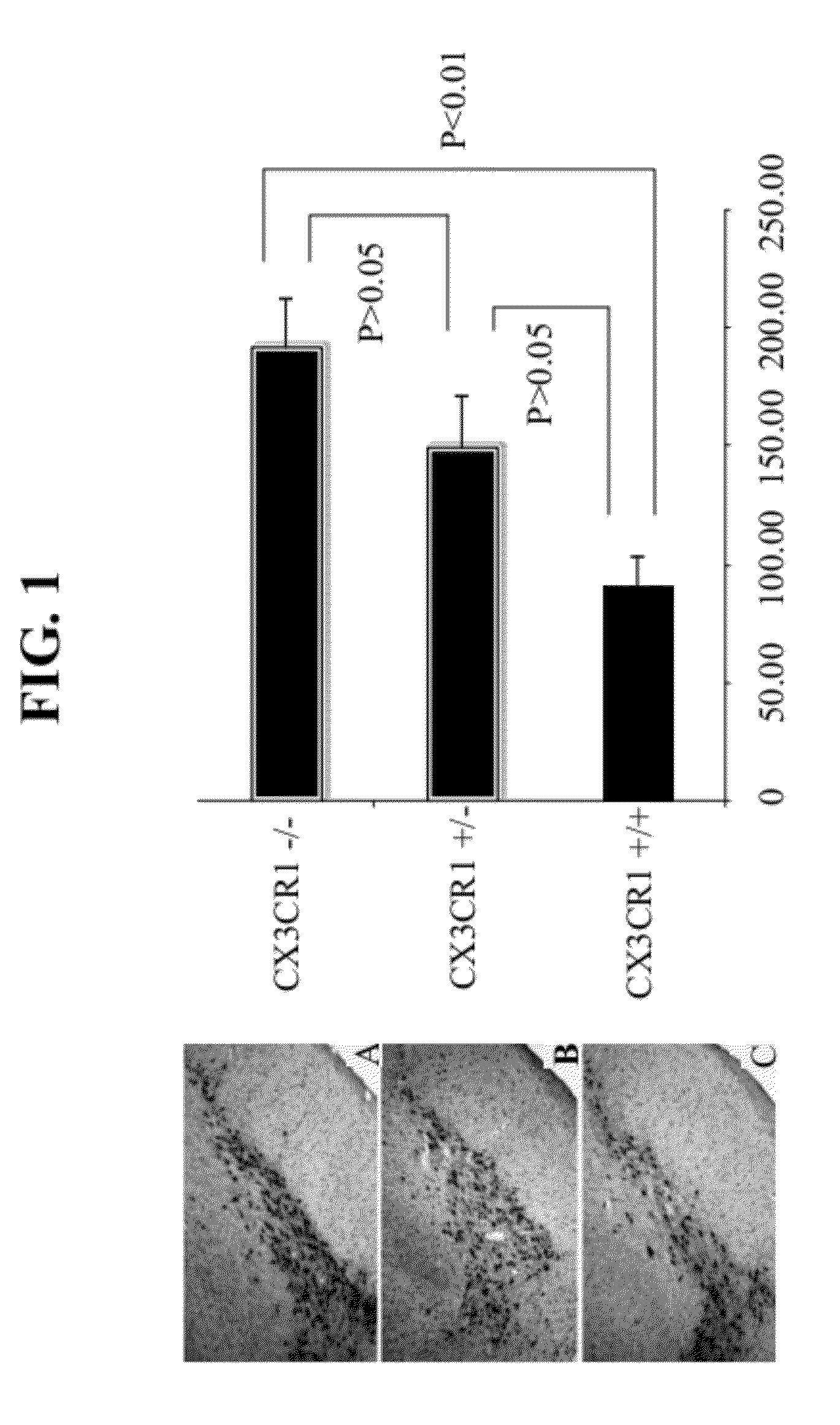 Methods and compositions for regulation of neurological conditions