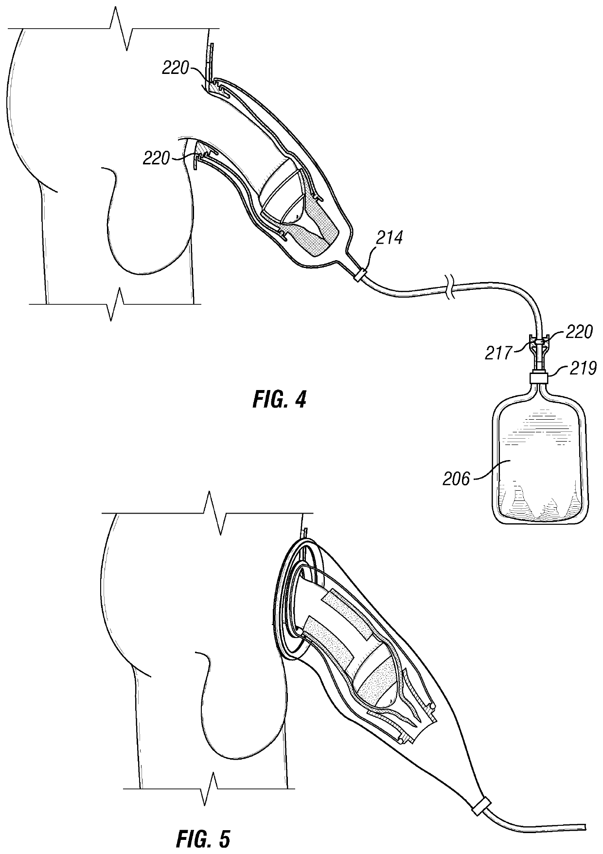 Urine collection apparatuses