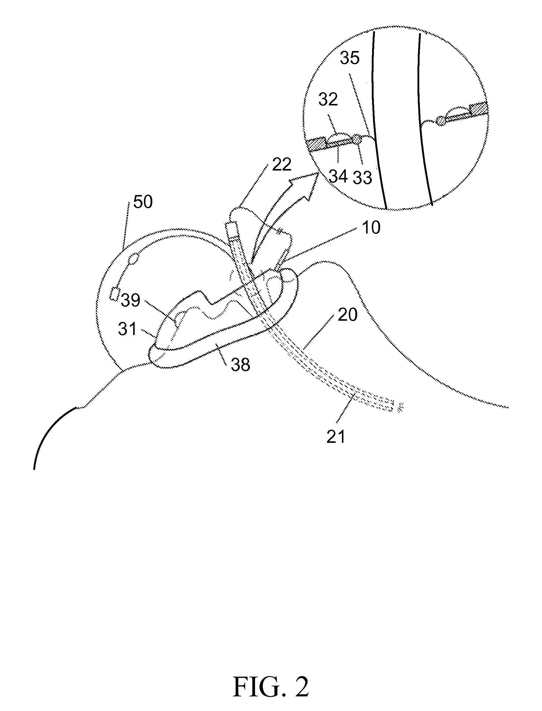 Facial mask and endotracheal intubation system