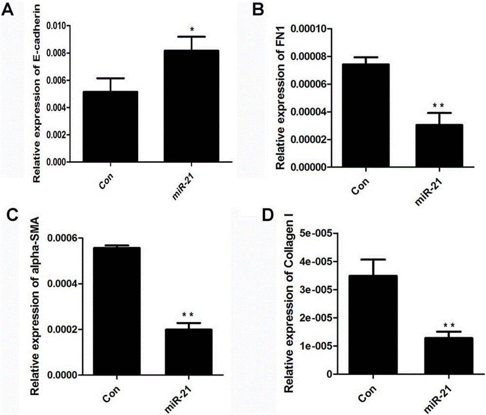 Application of miR-21 in preparation of medicine for treating intrauterine adhesion and/or thin inner membranes