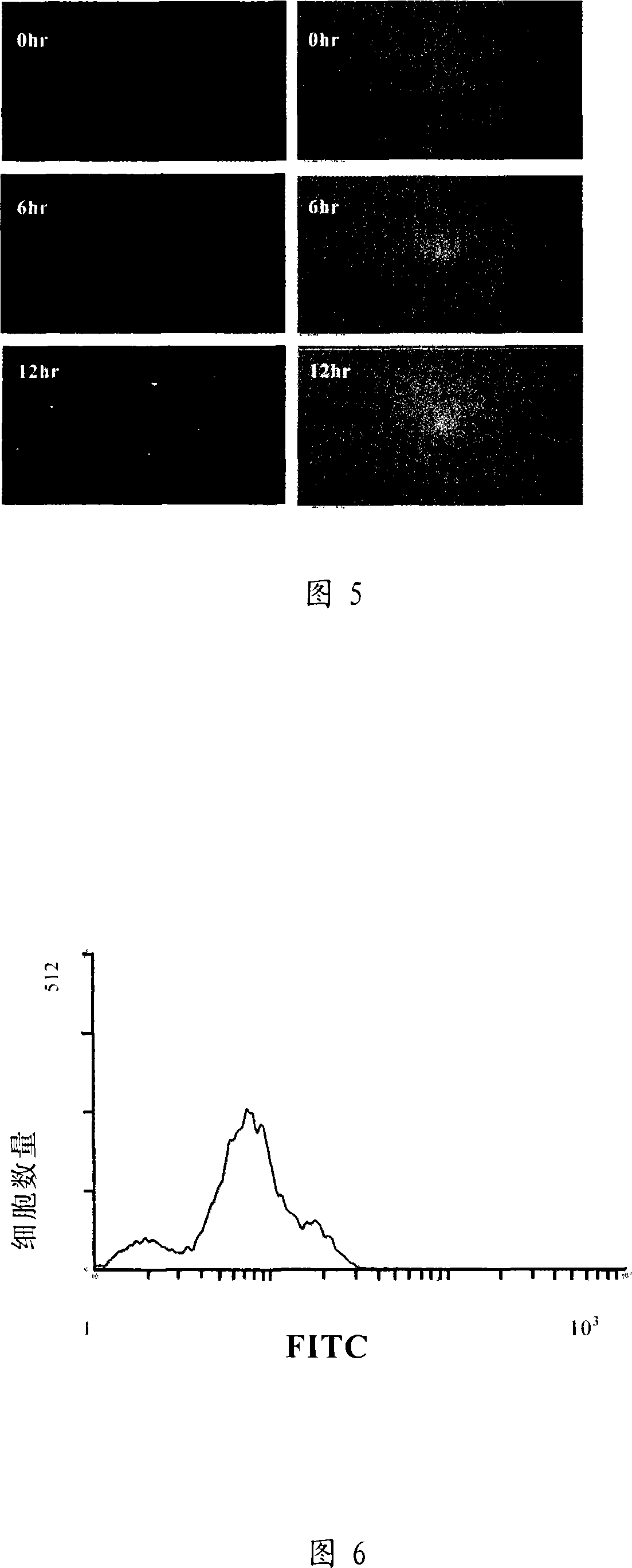 Transgenic salmon calcitonin gene yeast as well as preparation method and uses thereof