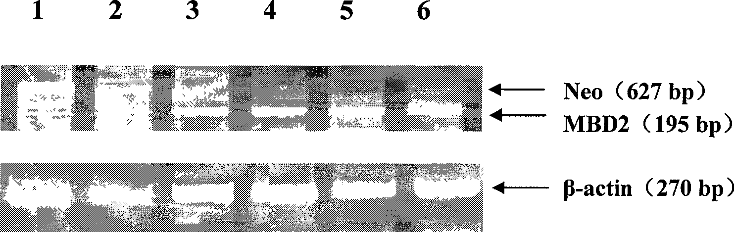 Construction method of Beta-alexin-2-tumor vaccine and uses thereof