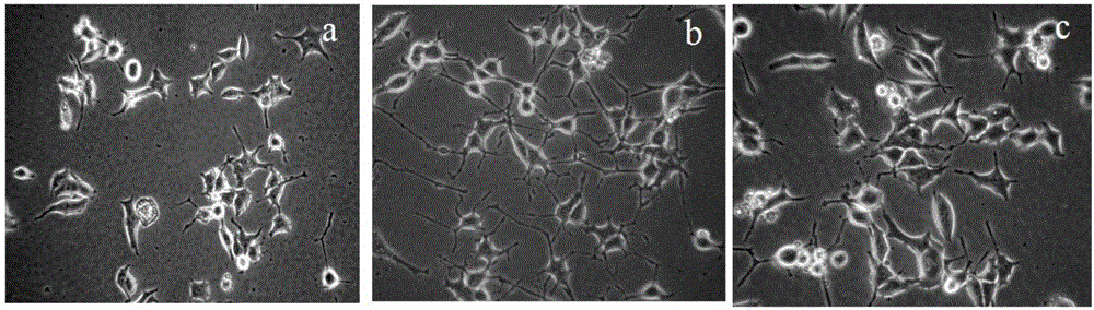 Ceramide compound and application