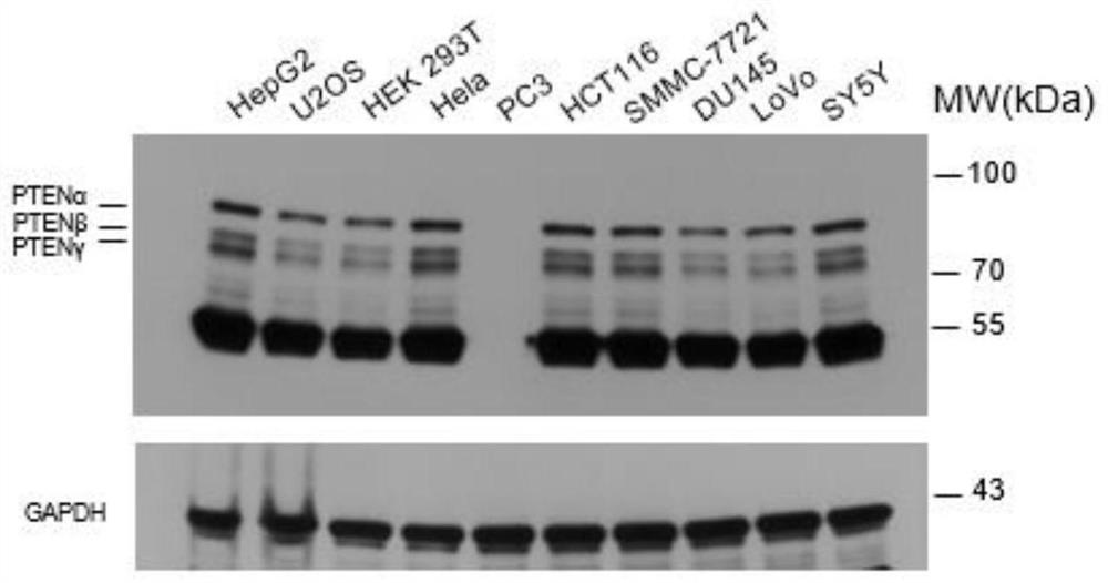 PTEN subtype protein PTEN gamma participating in telomere length regulation and application thereof