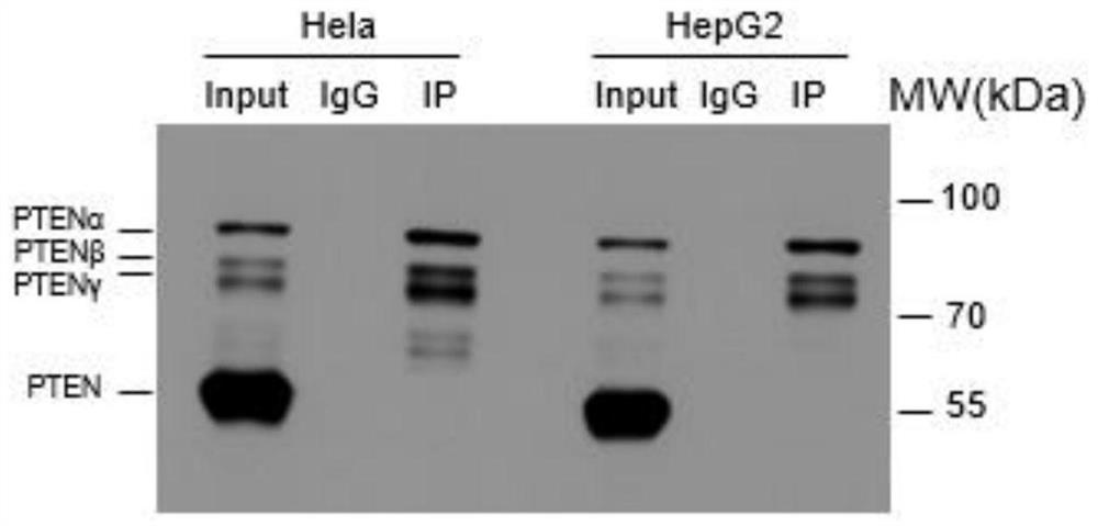 PTEN subtype protein PTEN gamma participating in telomere length regulation and application thereof