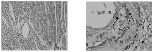 Composition for treating coronary heart disease