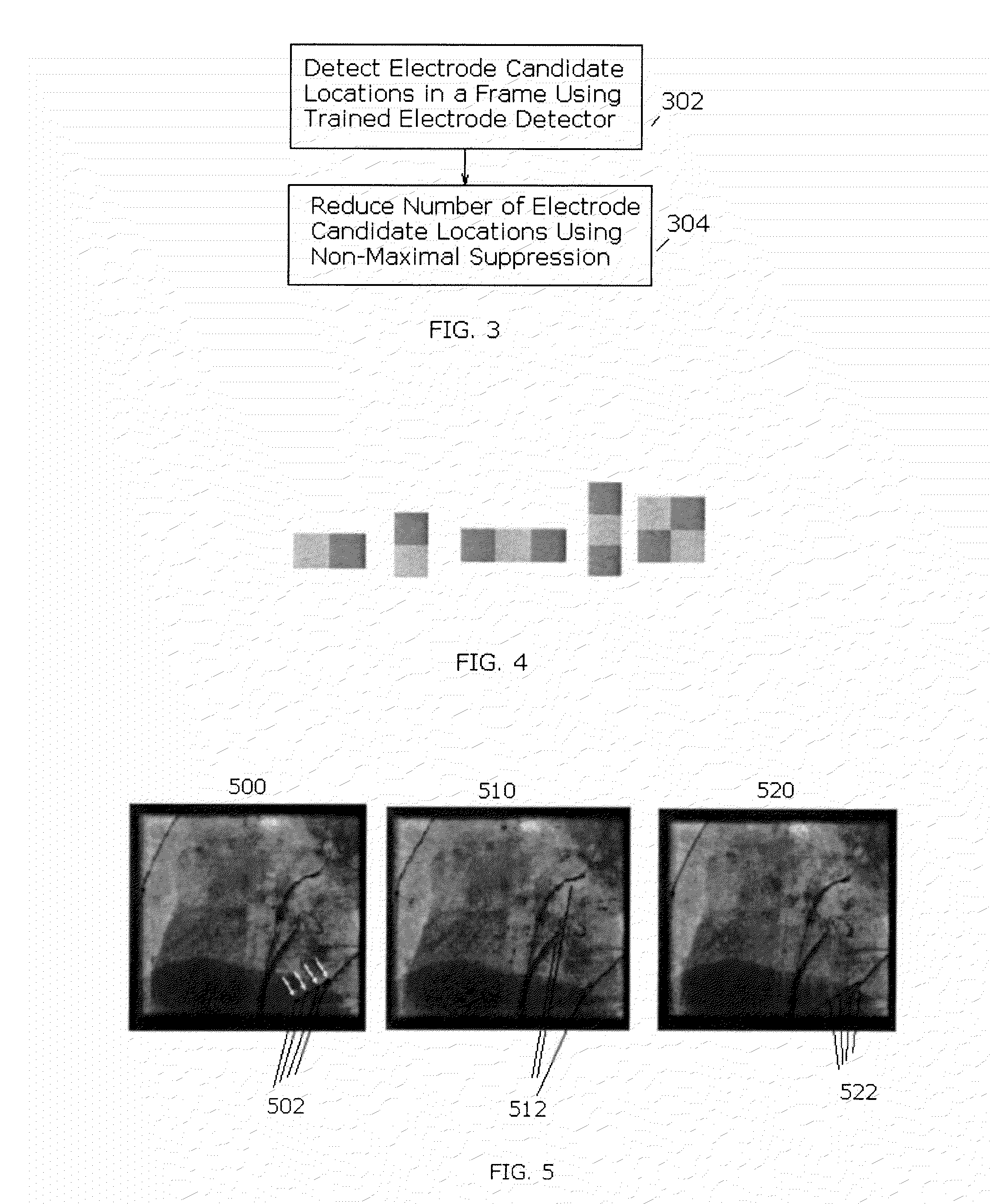 Method and System for Tracking Catheters in 2D X-Ray Fluoroscopy Using a Graphics Processing Unit
