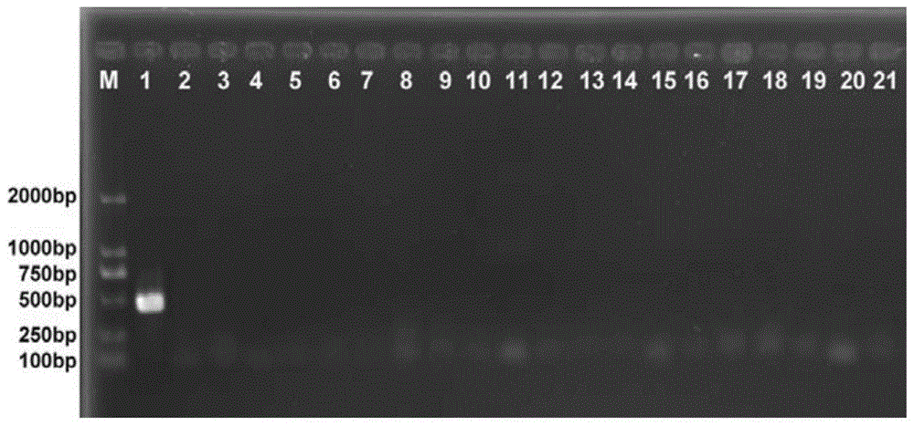 A set of primers used to identify stored grain pests of pseudocereals and their applications