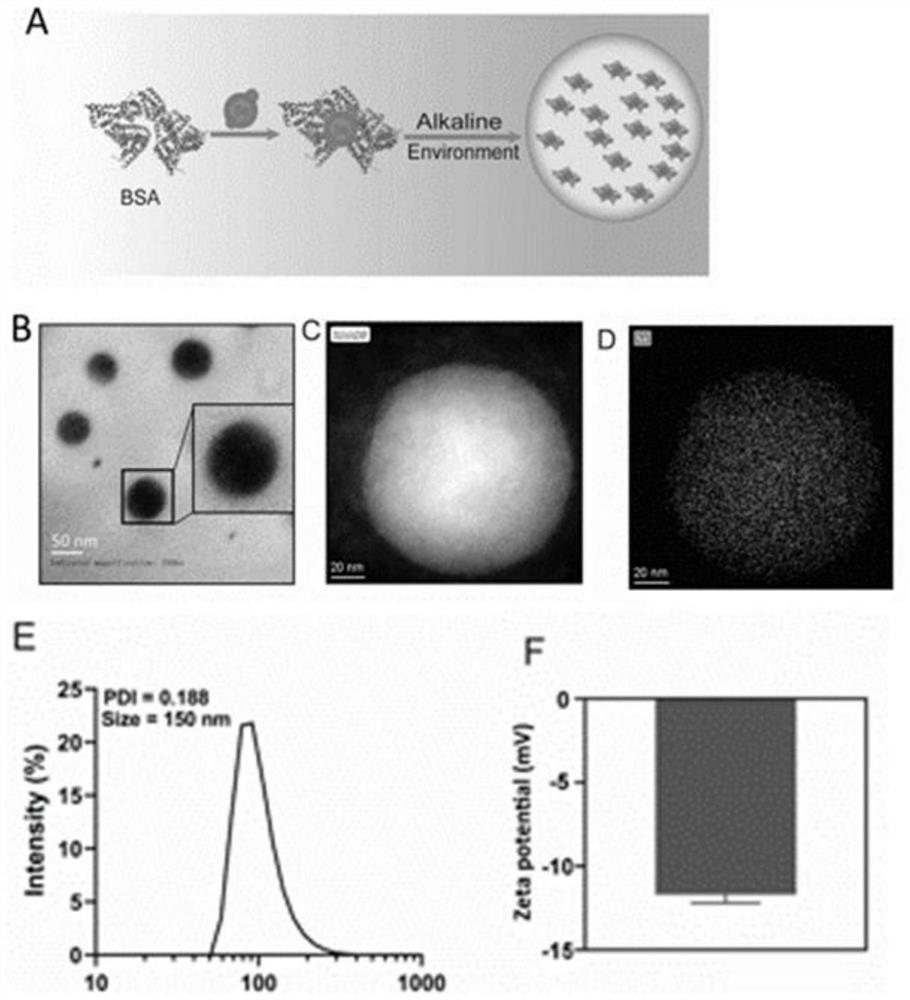 Preparation method of Se-coated BSA nano-drug and application of Se-coated BSA nano-drug in acute kidney injury