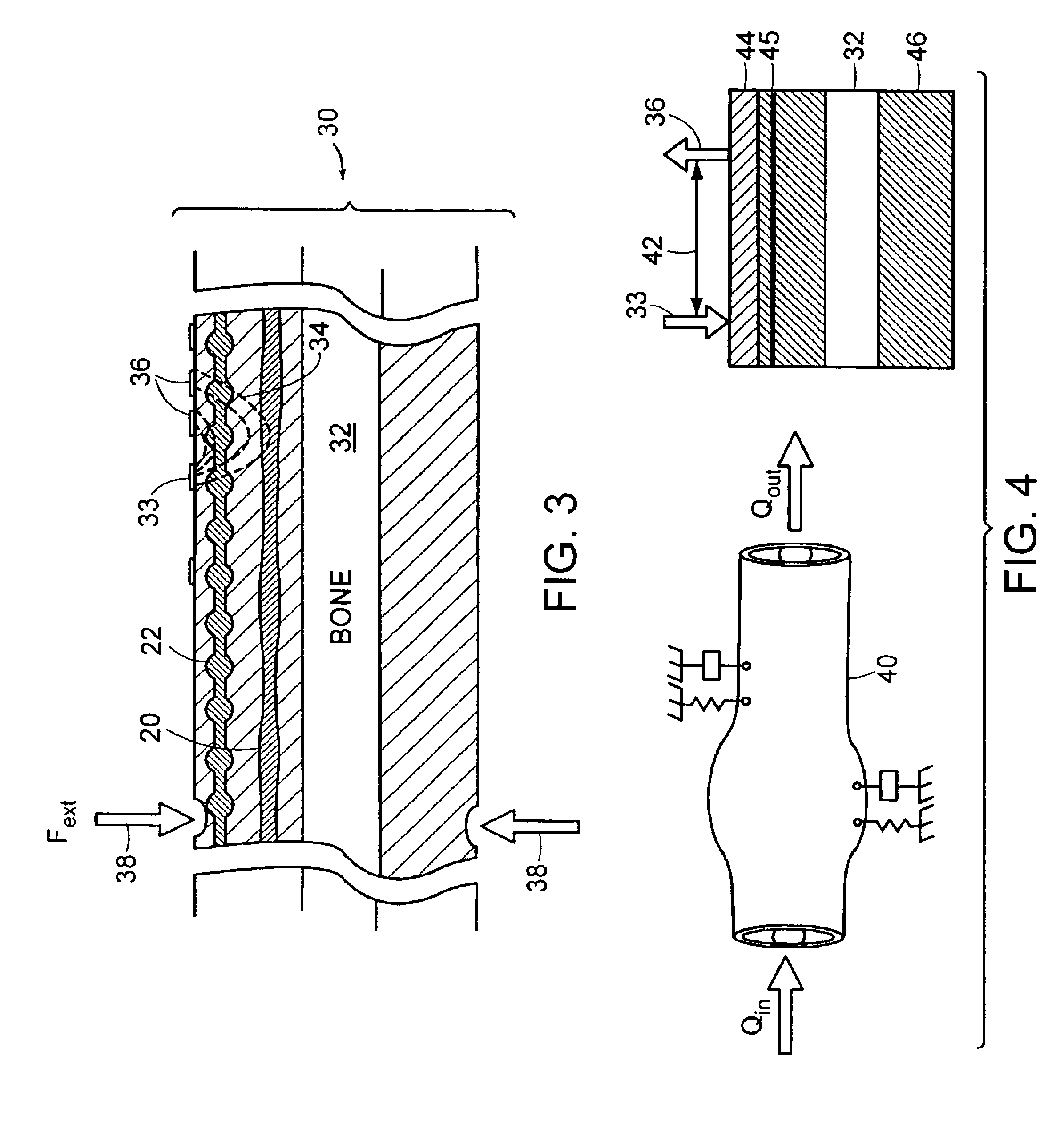 Vibratory venous and arterial oximetry sensor