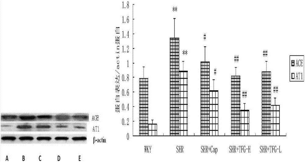 Application of gynostemma pentaphylla general flavone in preparation of medicines for preventing and treating cardiac hypertrophy